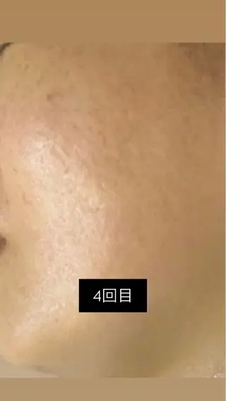 韓国🇰🇷価格 サロン_Nbibiの眉毛・アイブロウイメージ