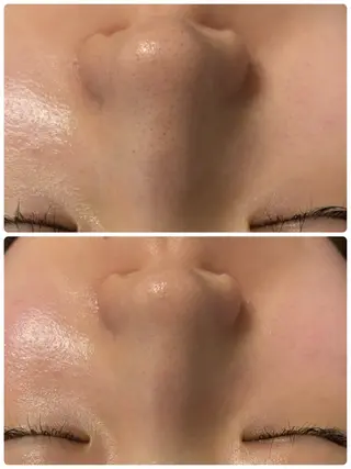 Moena. 武蔵小杉🫧のエステ・リラクイメージ