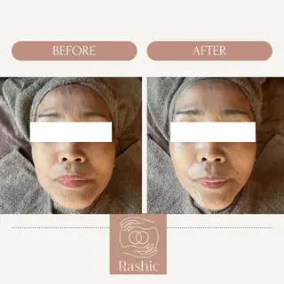 ReN エステサロンのエステ・リラクイメージ