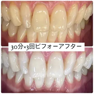 ホワイトニングルーム 横浜店のその他イメージ