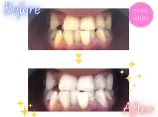 メンズ nanami -ホワイトニングのその他イメージ