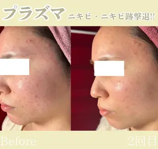 池田 桃花のエステ・リラクイメージ