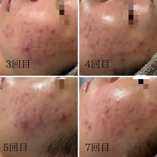 lumi riseのエステ・リラクイメージ