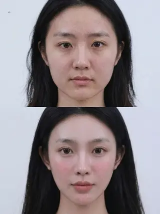 ネイル aliaハーブ水光店 エステティシャン募集のエステ・リラクイメージ