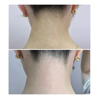 WhiteWax 堺東店のエステ・リラクイメージ