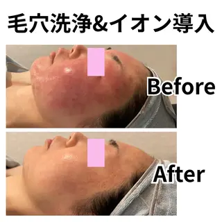 林 陽向のエステ・リラクイメージ