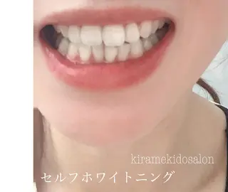 林 禅のネイルデザイン