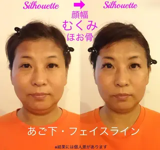 筋膜整体＆小顔矯正 　姿美人.シルエットのエステ・リラクイメージ
