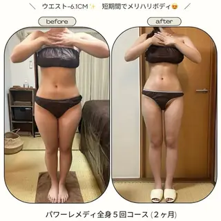 《本気痩せ×疲労改善 》  BILOOPのエステ・リラクイメージ