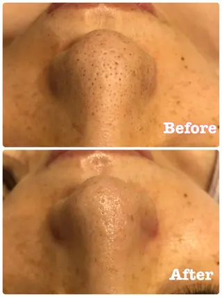 加藤 葵のエステ・リラクイメージ