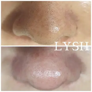 エステサロン LYSHのその他イメージ