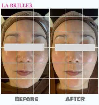 LA BRILLERのエステ・リラクイメージ