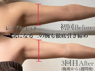 🌸🧡六本木 脱毛しずか🧡🫧の眉毛・アイブロウイメージ