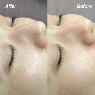 🌿hitomi🌿 艶肌/肌質改善のエステ・リラクイメージ