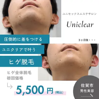 メンズ 佐賀 痩身・美肌 @uni.clearのエステ・リラクイメージ