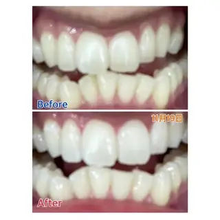 M渋谷 ホワイトニングのエステ・リラクイメージ