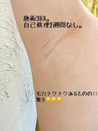 セルフ脱毛 atelier aoのエステ・リラクイメージ