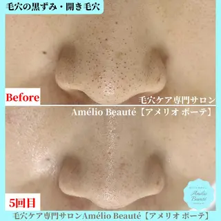 毛穴ケア専門サロン アメリオボーテのその他イメージ
