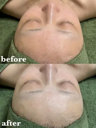 肌質改善＆脱毛 【M Mondo】のエステ・リラクイメージ