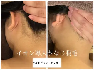 🎀うなじ脱毛🎀 ㅣLino堀江のエステ・リラクイメージ