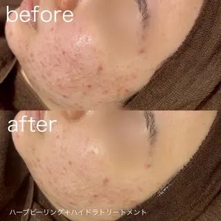 lulularico Yuのエステ・リラクイメージ