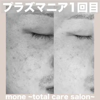 mone~total care salon~所属・mone (モーネ)のエステ・リラクイメージ