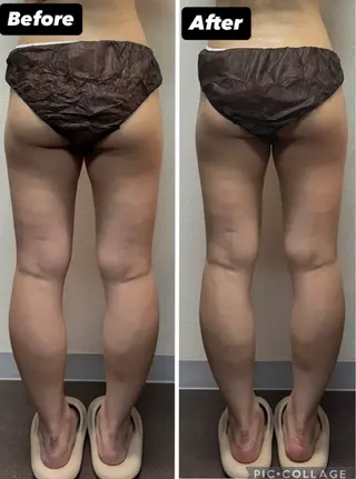 ハイパーナイフ専門店　Salon de COCO所属・Salon de COCOのエステ・リラクイメージ