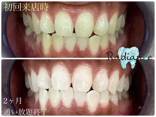 札幌ホワイトニング ラディアンス札幌駅店のその他イメージ