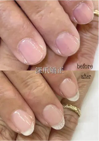 ネイル prizeIris 東のネイルデザイン