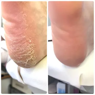 ⭐️遠藤 夏純⭐️のエステ・リラクイメージ