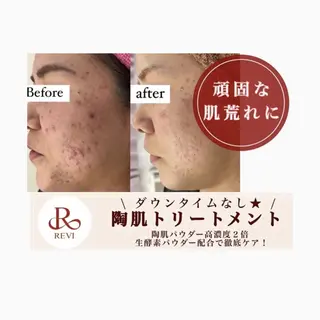 Horishia 福岡博多店のエステ・リラクイメージ