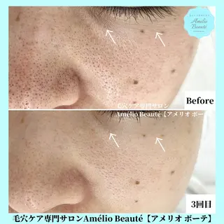 毛穴ケア専門サロン アメリオボーテのその他イメージ