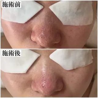 BEAUTY SALON BeLL所属・毛穴ケア専門店 BeLL ベルのエステ・リラクイメージ