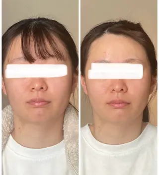 美骨エステサロン LuxAのエステ・リラクイメージ