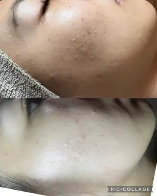 ネイル Feel ‪‪☺︎‬Yuriaのネイルデザイン