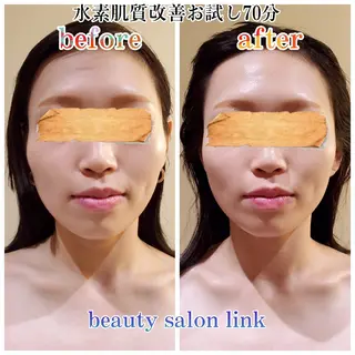 beauty salon  link所属・水素エステと美容脱毛 salon Linkのエステ・リラクイメージ