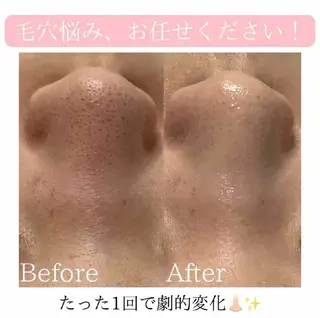 マツエク・マツパ aliaハーブ水光店 エステティシャン募集のエステ・リラクイメージ