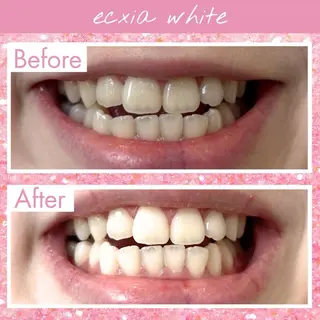 セルフホワイトニング エクシア仙台駅東口店のその他イメージ