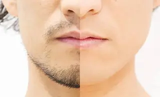 肌管理♡脱毛 Face Lab.のその他イメージ