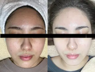 代表 MOMOのエステ・リラクイメージ