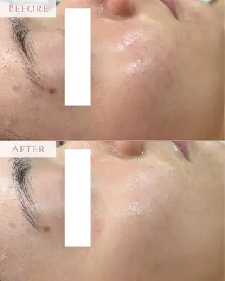 肌質改善専門サロン Bellmi/心斎橋のエステ・リラクイメージ