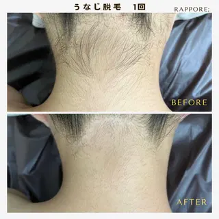 脱毛＆フェイシャル/ Rappore;増田のエステ・リラクイメージ