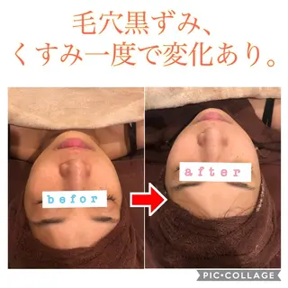 セミロング カラー パーマ ヘアアレンジ メンズ キッズ ネイル マツエク・マツパ 金の糸脱毛 産毛ケア専門のエステ・リラクイメージ