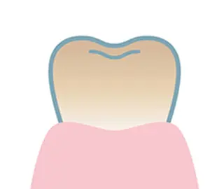 ホワイトニング シャトンのその他イメージ
