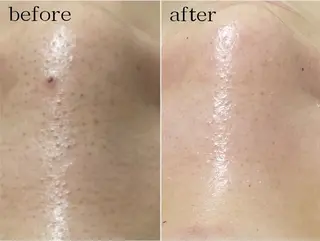 ビューティーサロン ア・クイーユのエステ・リラクイメージ