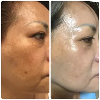 宜野湾美肌脱毛fuu okinawaタイラのエステ・リラクイメージ