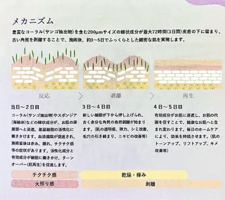 ニキビ 毛穴ケア シャルム ココ みさのエステ・リラクイメージ