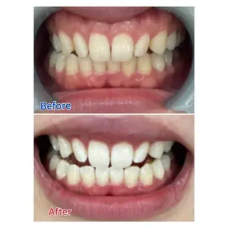 M渋谷 ホワイトニングのエステ・リラクイメージ