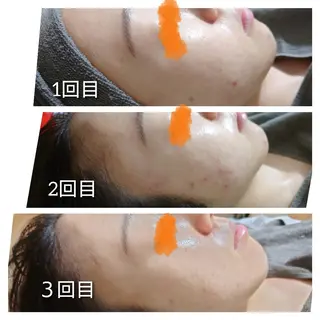 Luanaまつパ脱毛 ハーブピーリング眉毛のマツエク・マツパデザイン