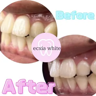 セルフホワイトニング エクシア旭橋店のその他イメージ